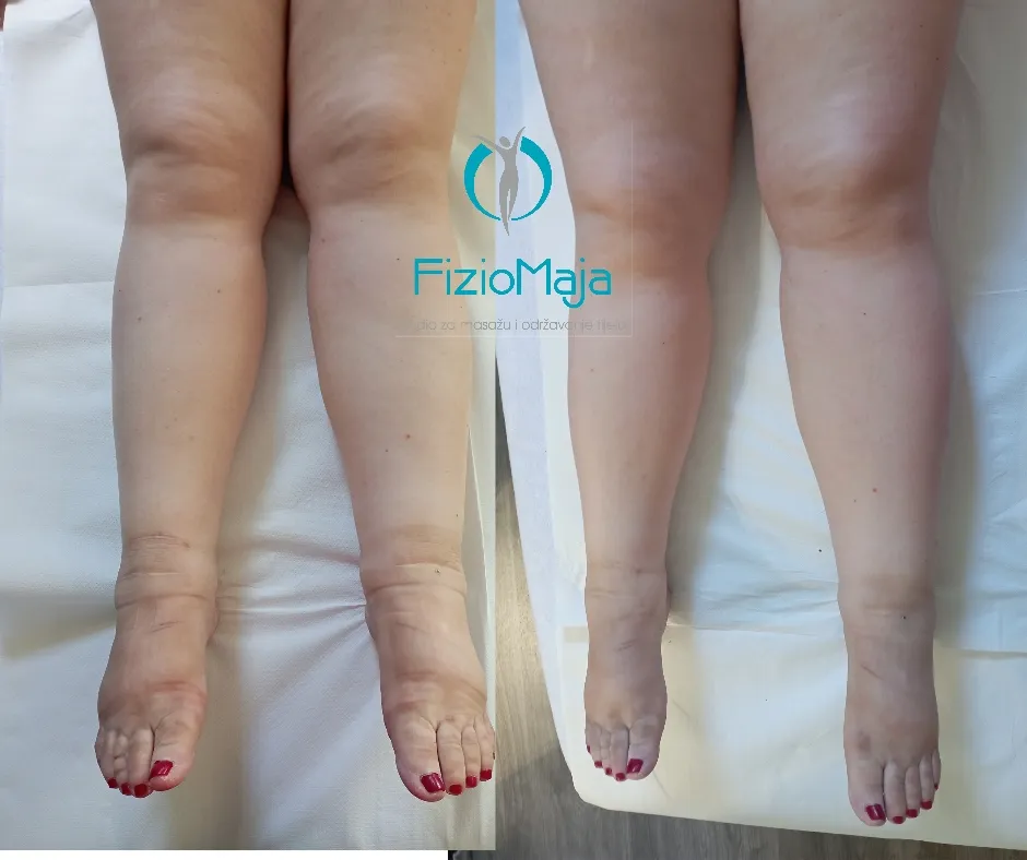 FizioMaja